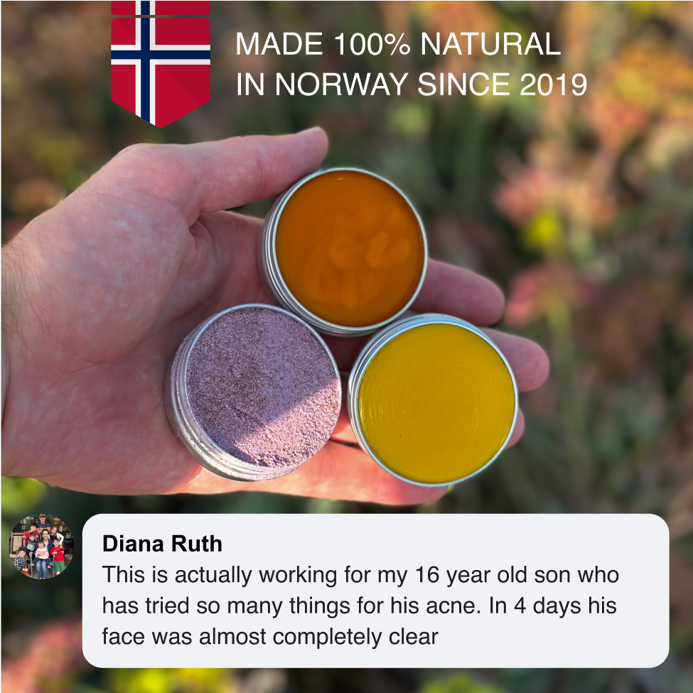 Hand holding three Acne Stopper Starter Pack jars with a made-in-Norway badge and a testimonial