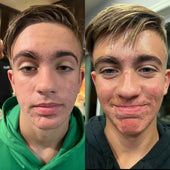 Copy of Before After #DQZ9QTRM