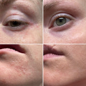 Before and After
