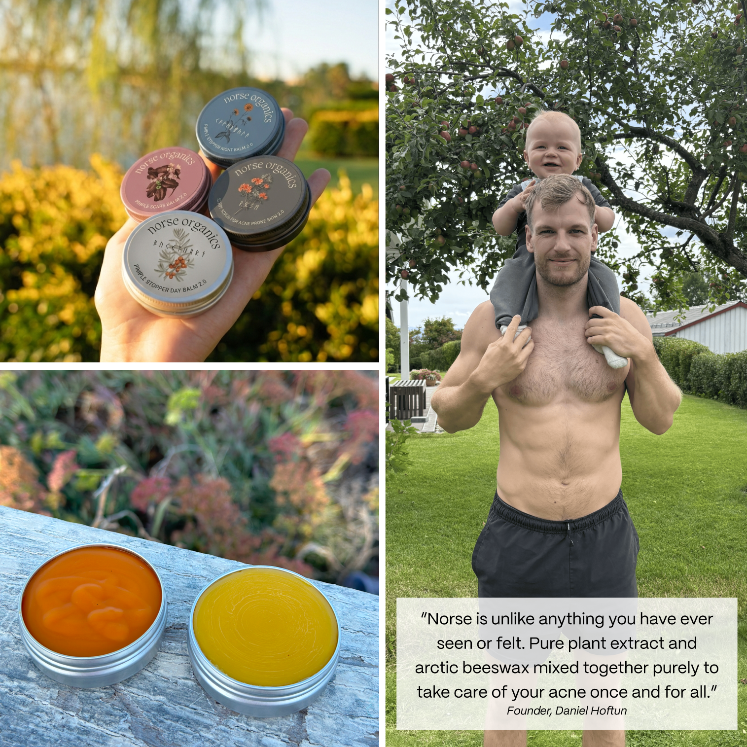 Lifestyle collage of Acne Killer System jars, open balms and the founder outdoors with a quote
