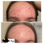 Copy of Before After #DQZ9QTRM