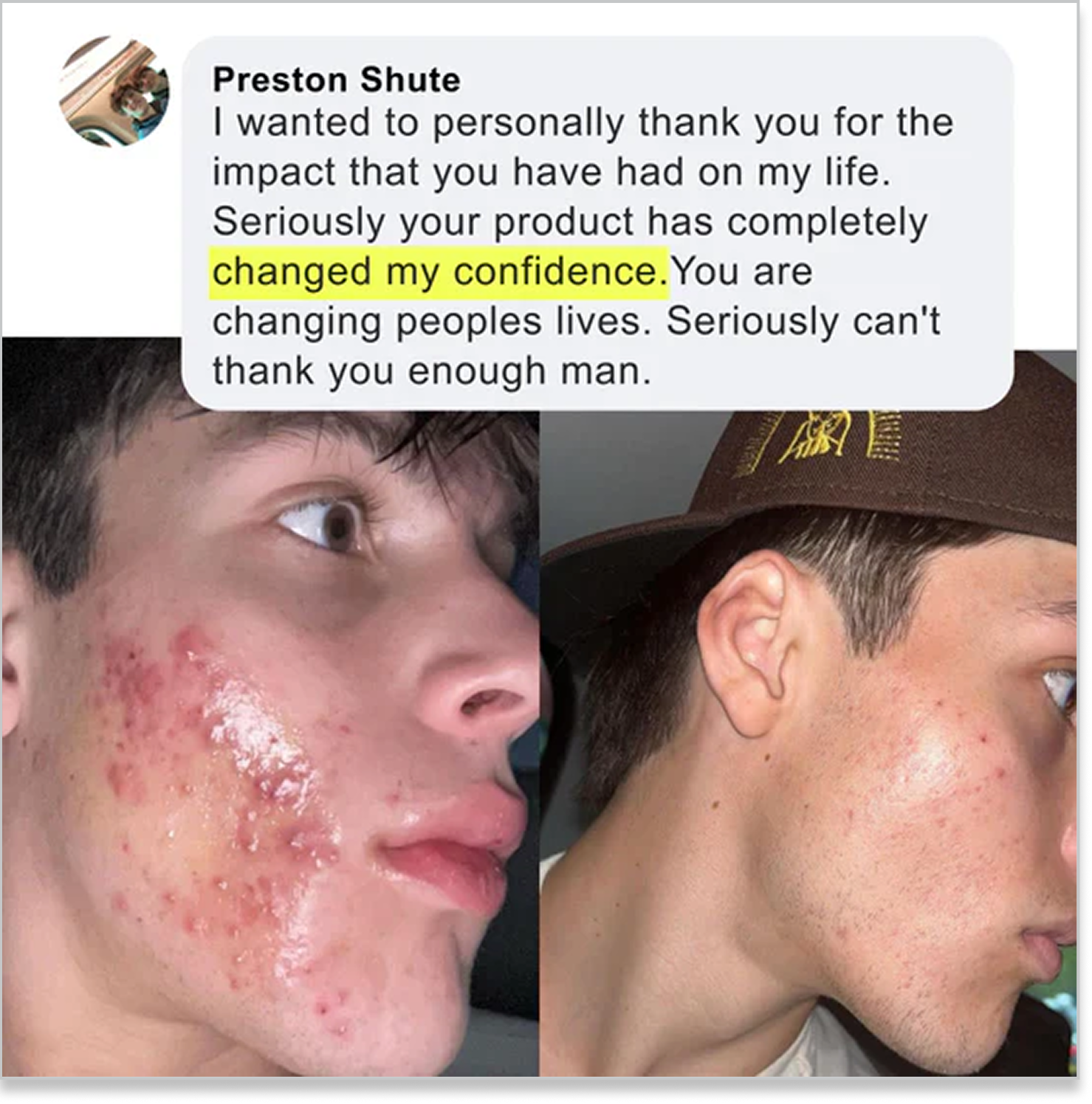 norse organics acne redness treatments