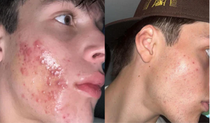 Before and After