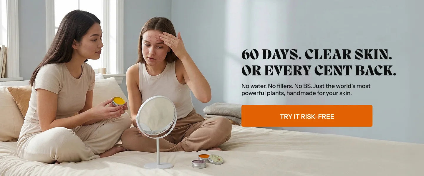 Norse Organics banner showing two women with a mirror and the 60-day clear-skin money-back guarantee