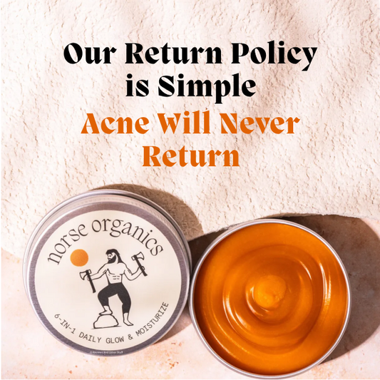 Open Acne Stopper Starter Pack day balm with a simple money-back guarantee graphic