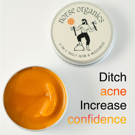 Open Acne Stopper Starter Pack day balm with a ditch-acne, gain-confidence message