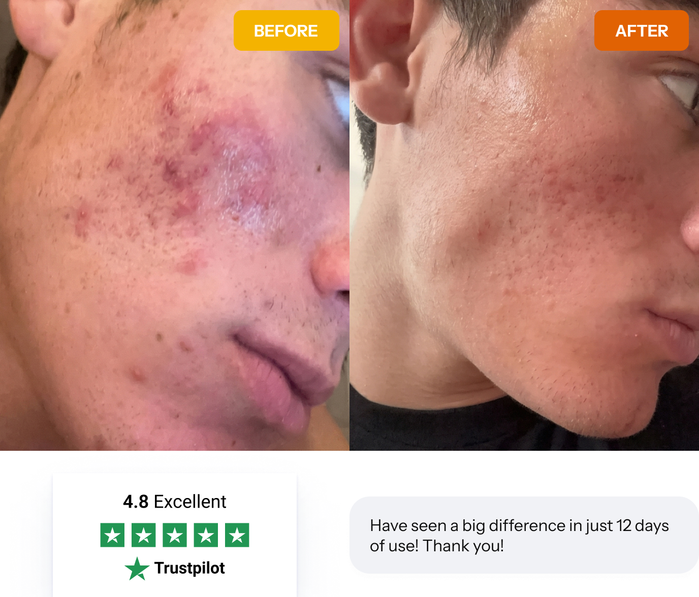 Norse Organics before and after results