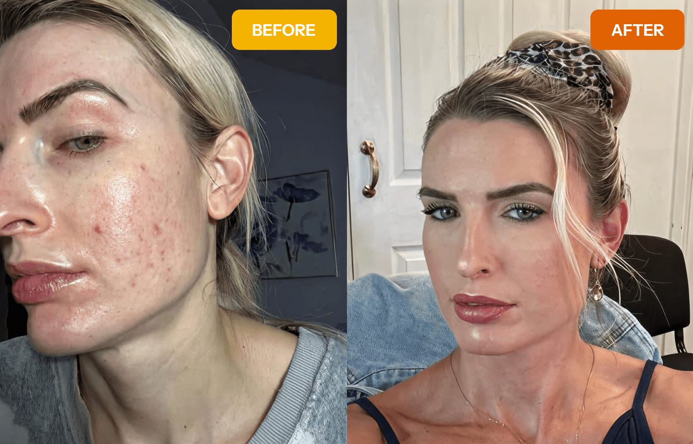 Norse organics before and after results