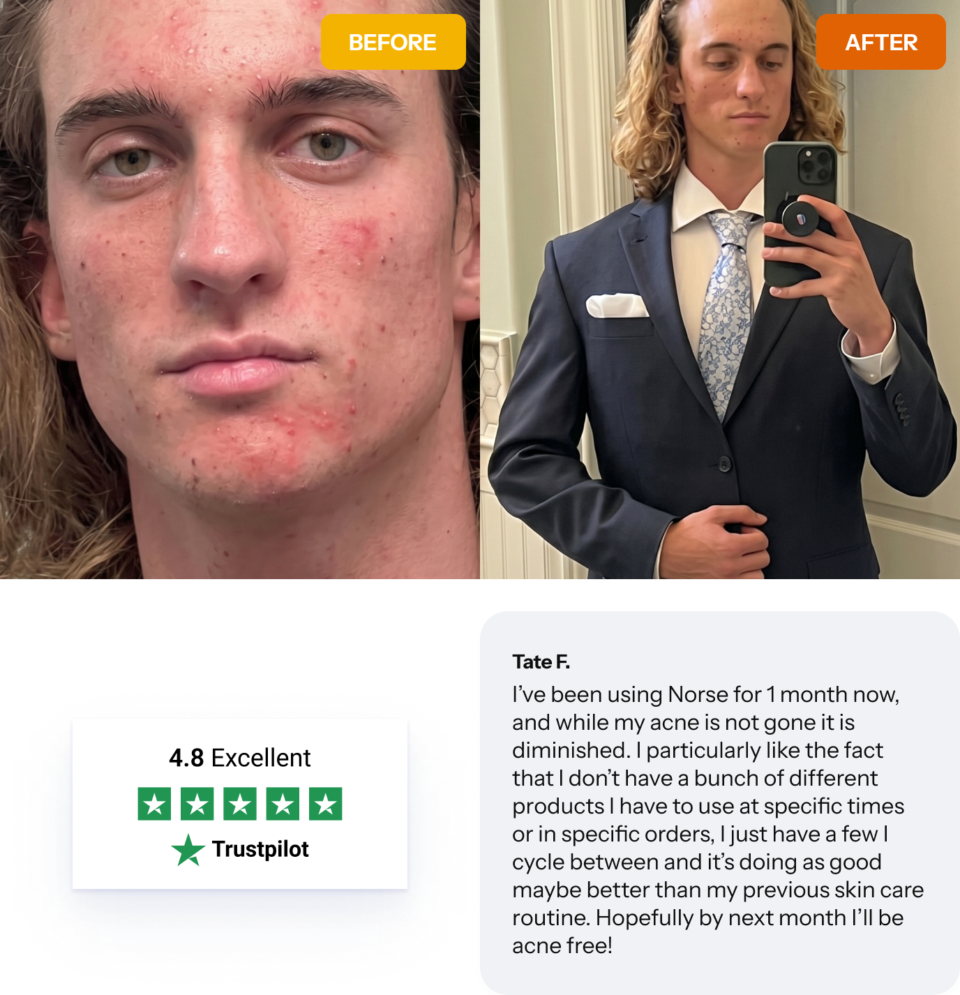 facial redness before and after results