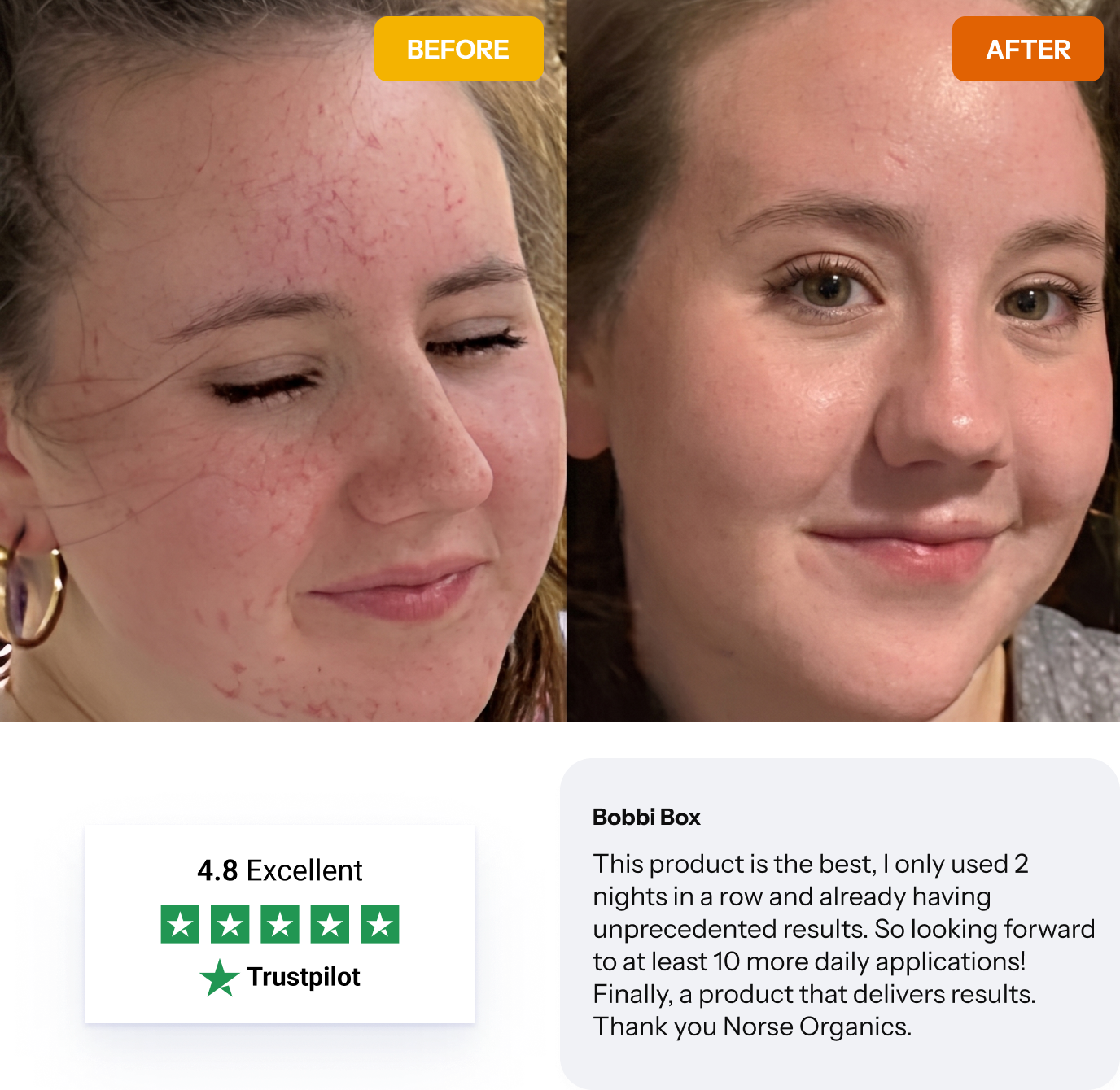 norse organics before and after transformation
