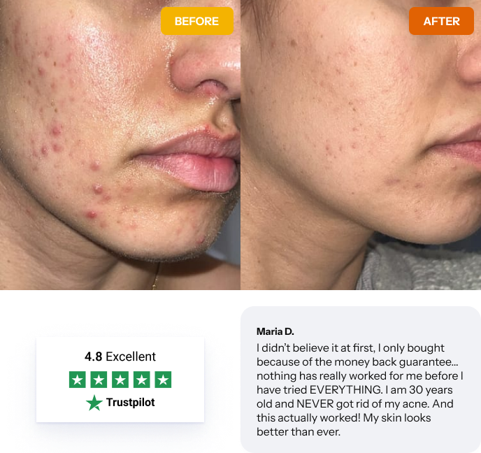 Norse Organics before and after transformation