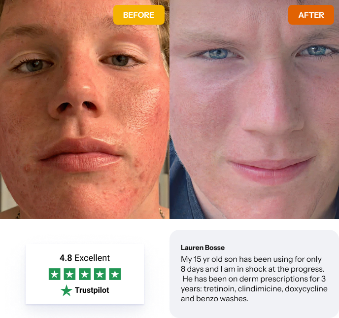 Norse Organic Acne Skincare