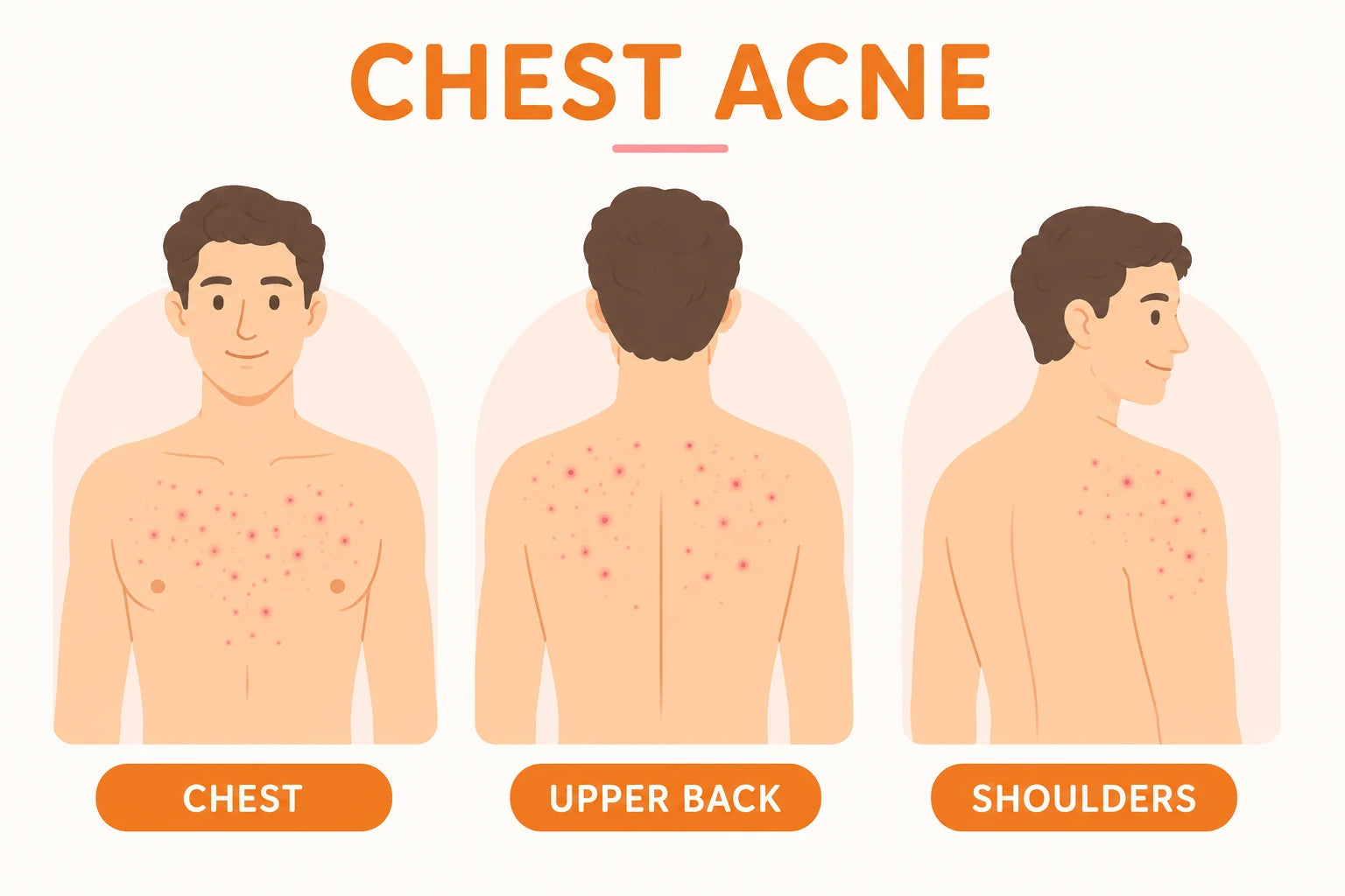 Close-up of chest acne breakouts