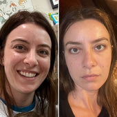 Copy of Before After #DQZ9QTRM