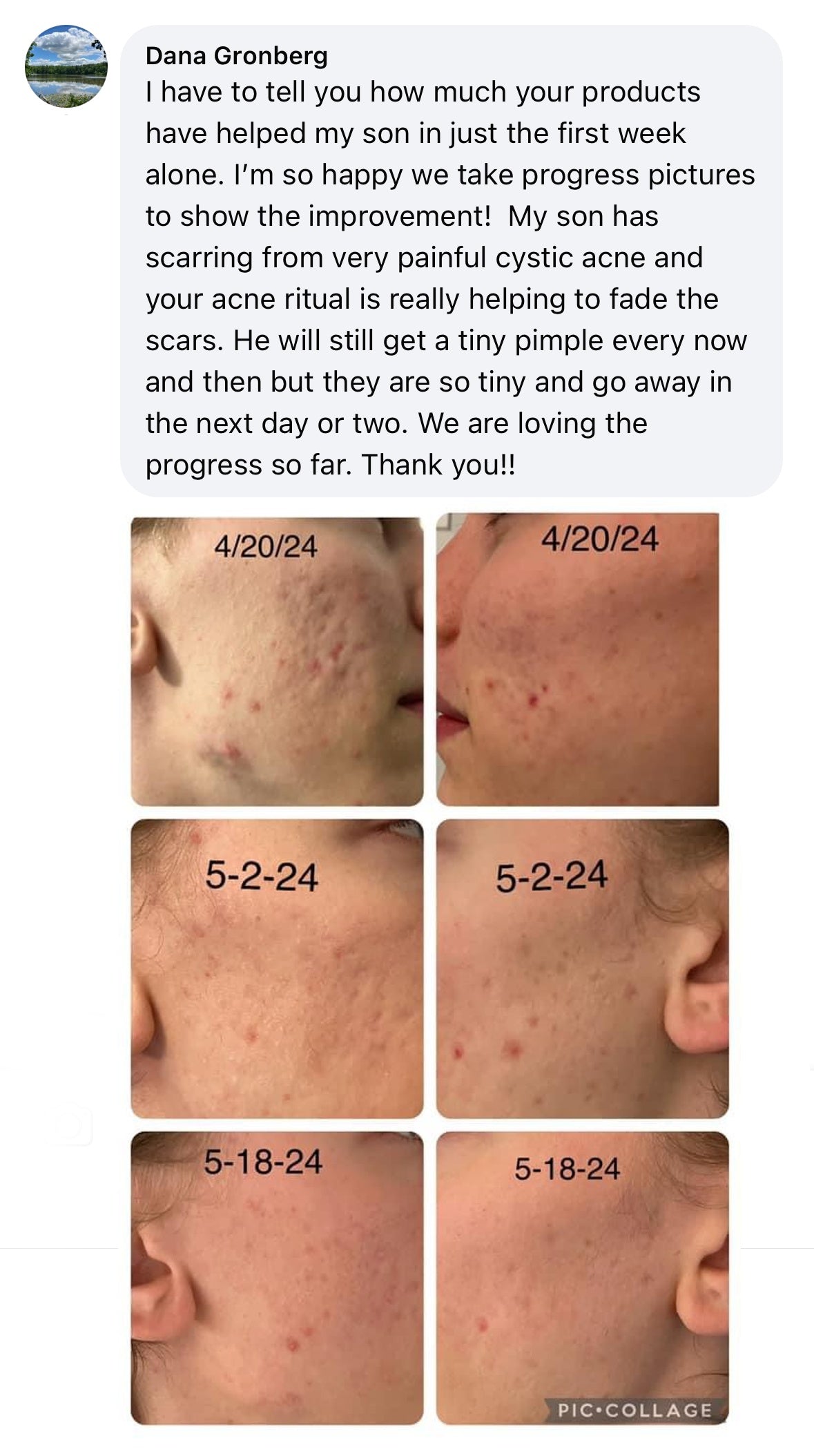 scars first image.jpg__PID:d25dc449-5a7b-4720-b10c-8e85f193bfe2