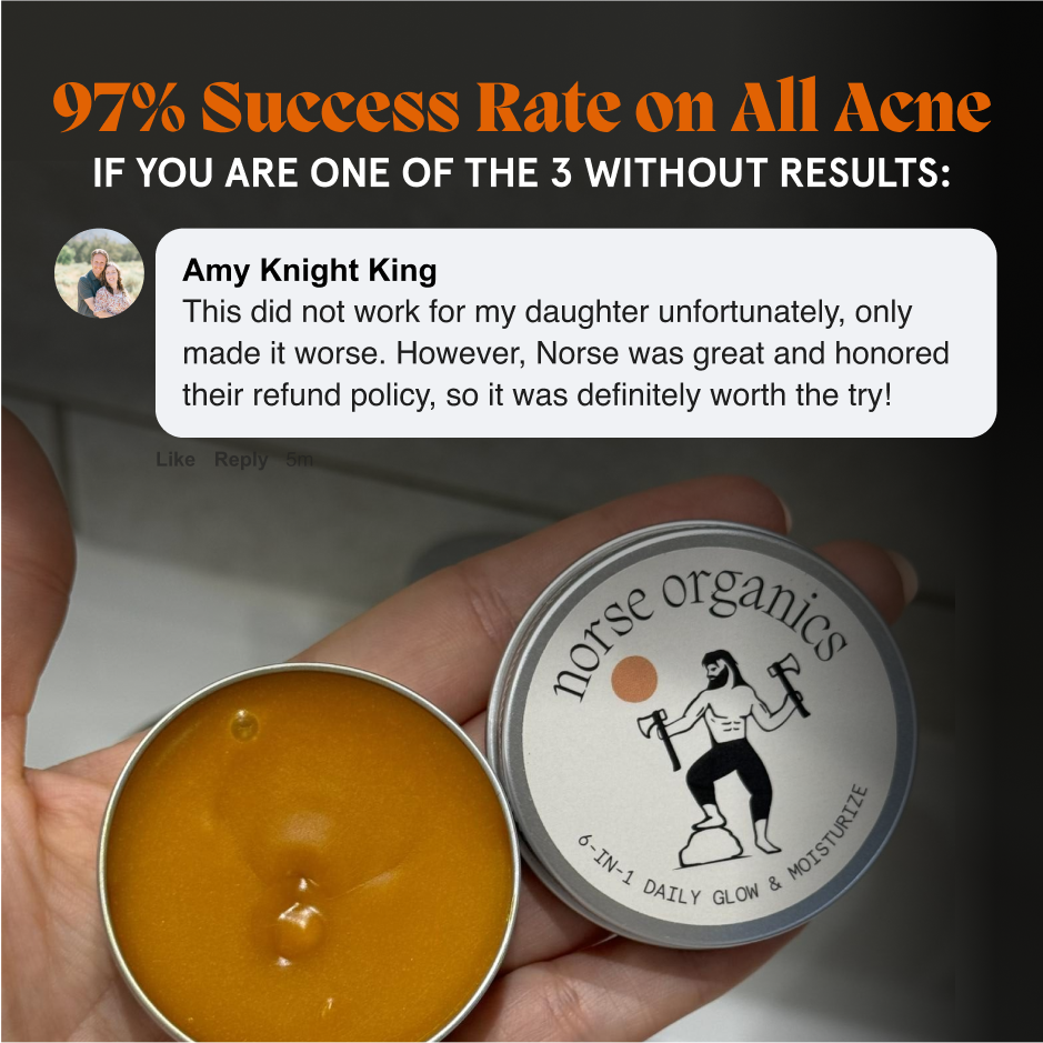 Open Acne Stopper Starter Pack day balm with a success-rate graphic and a customer testimonial